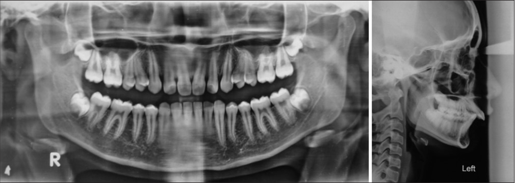 Pre-treatment orthopantomogram and lateral cephalogram.