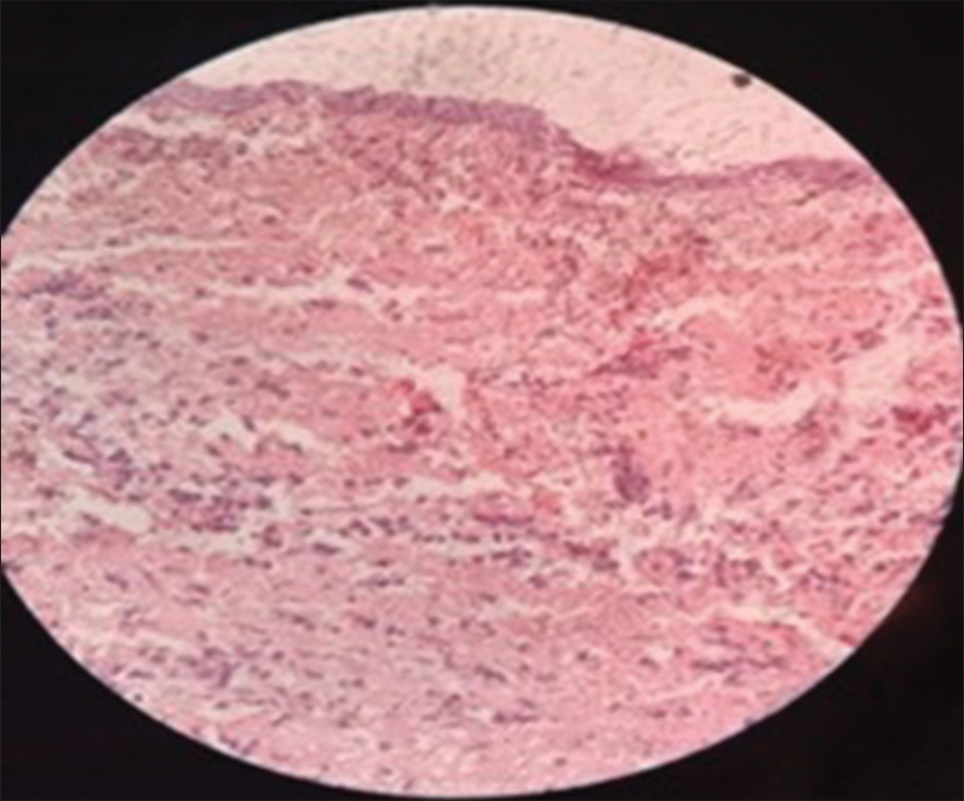 Histopathological analysis.