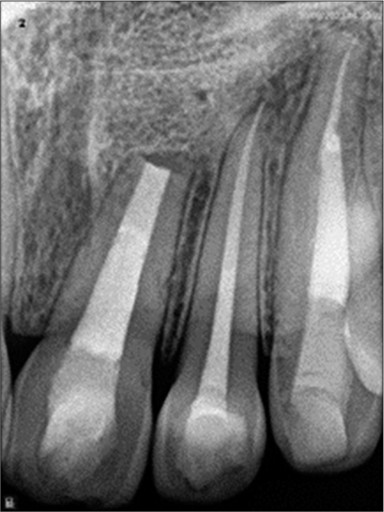 Follow-up periapical radiograph.