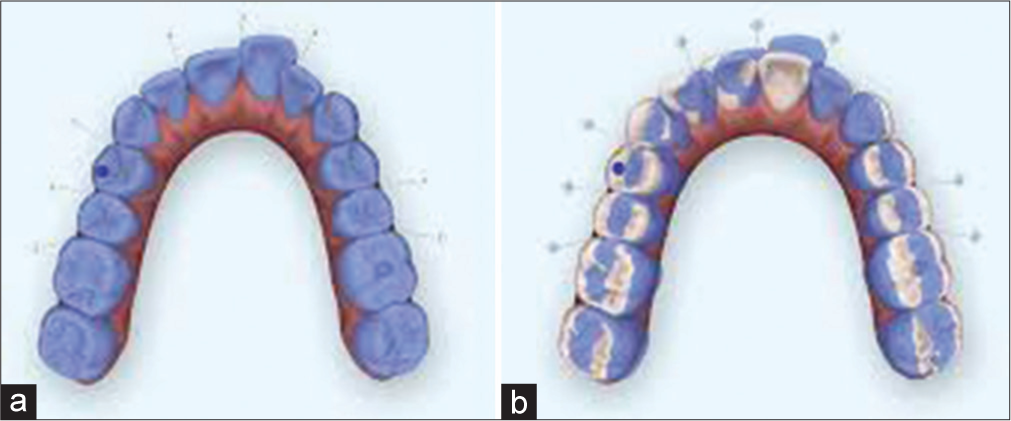 (a and b) Artificial intelligence and prediction of tooth movement.