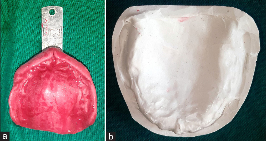 (a) Maxillary primary impression. (b) Maxillary primary cast.