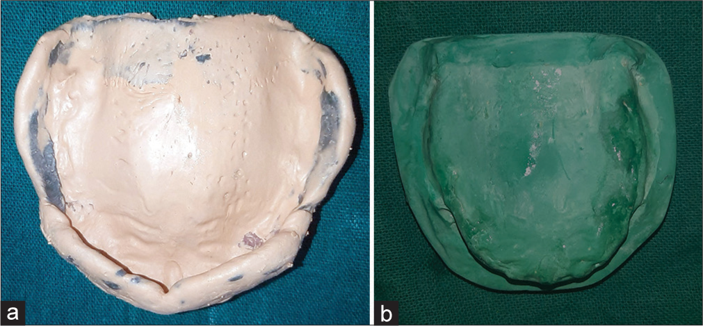 (a) Maxillary final impression. (b) Maxillary final cast.