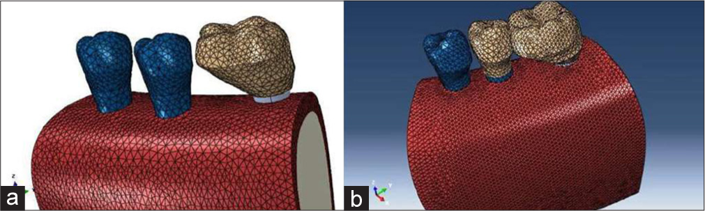 Mesh applied to the: a) first model and b) second model.